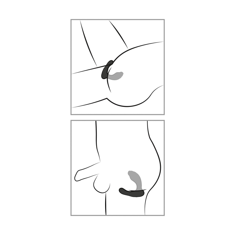 Sweet Smile RC G\ P -Spot Vibrator